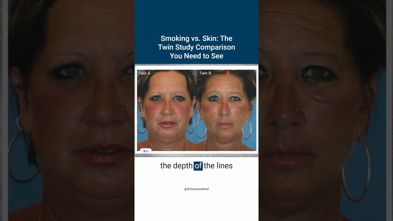 Smoking vs. Skin - The Twin Study Comparison You Need to See