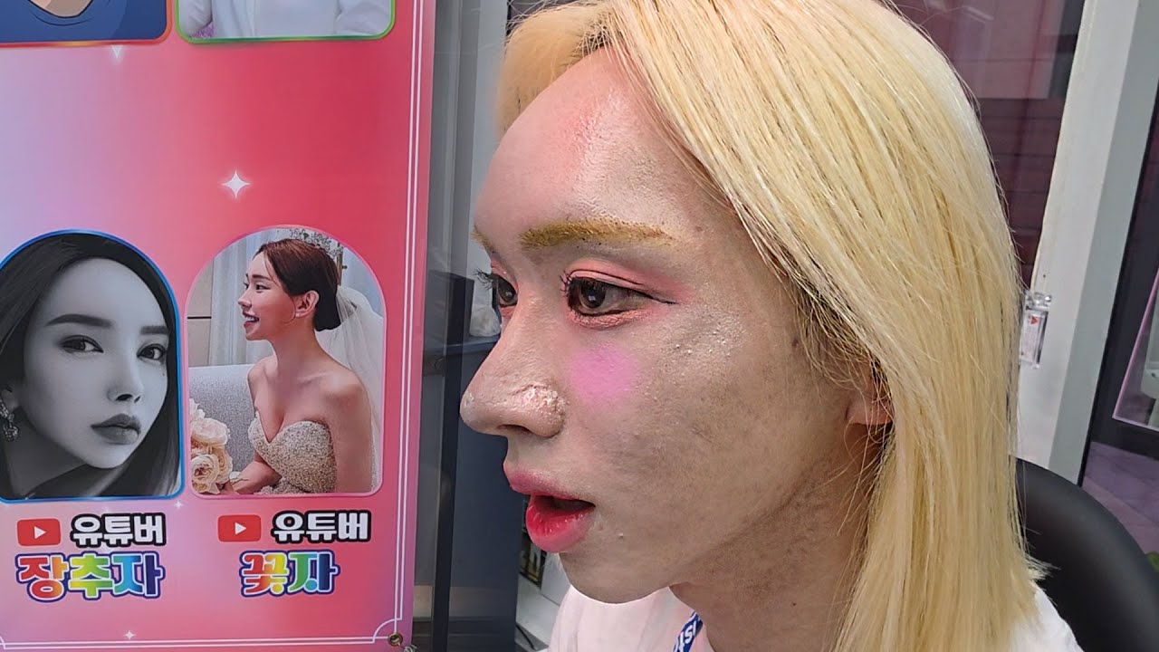 조현병 트랜스젠더