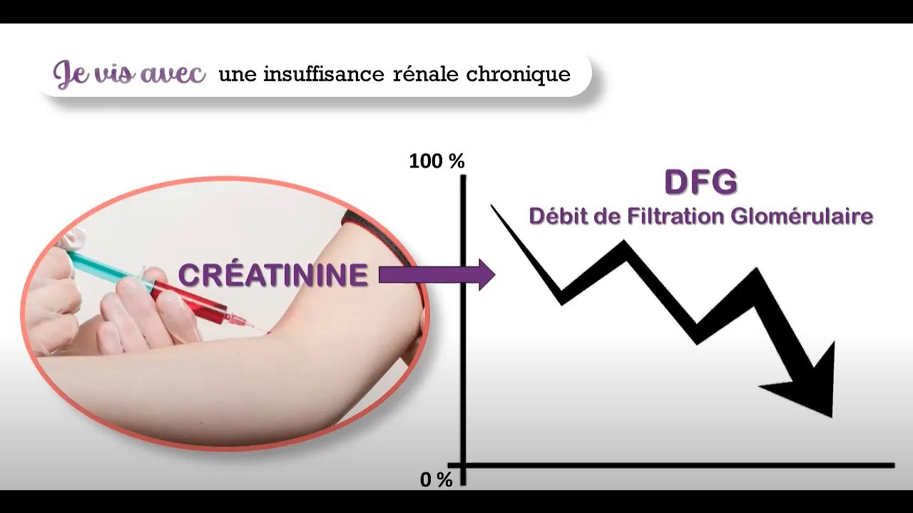 #2 - Je vis avec une insuffisance rénale chronique