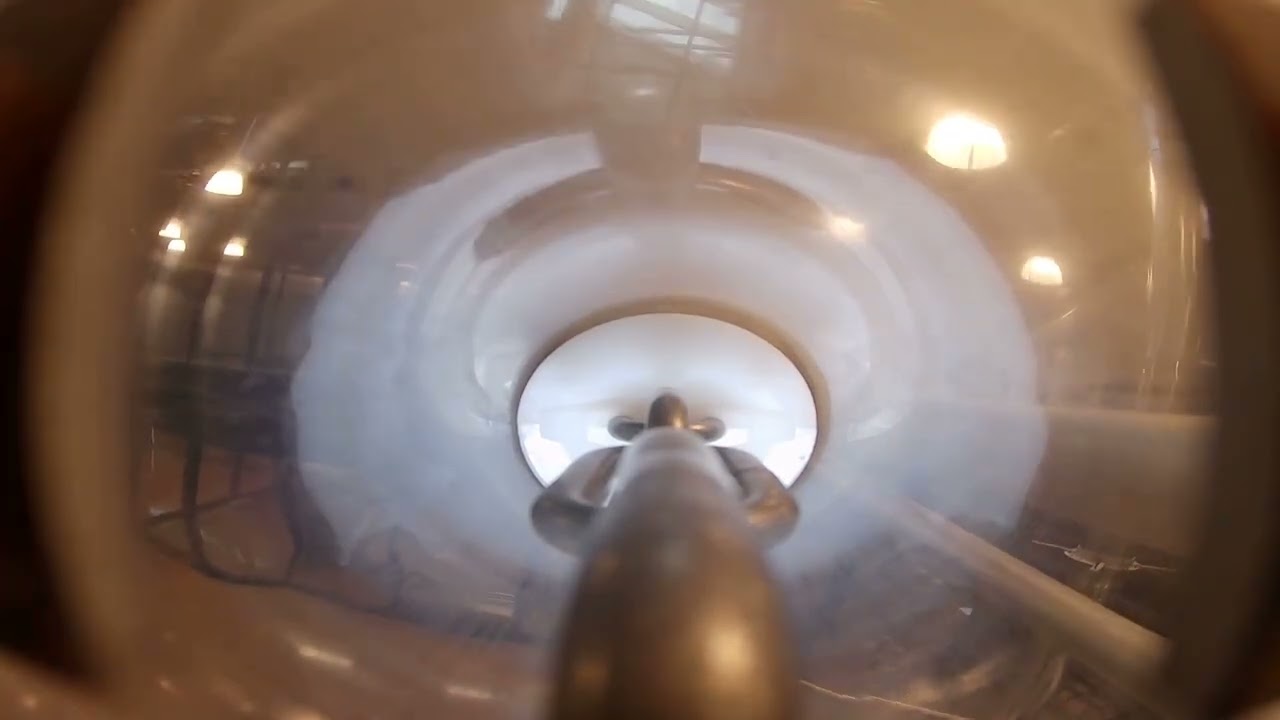 The View Inside a Chain-Vey