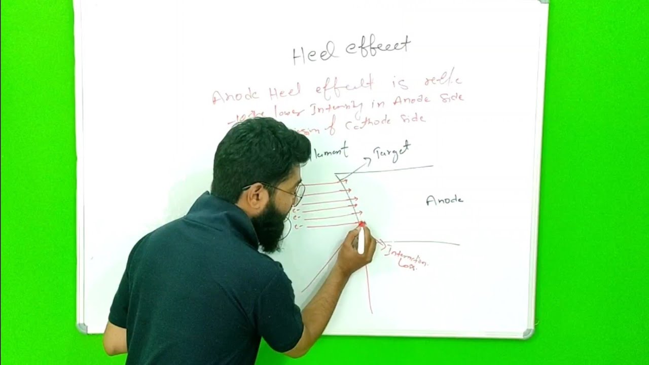 ANODE HEEL EFFECT | BASIC CONCEPT | IN HINDI | RADIOLOGY CLASSES |