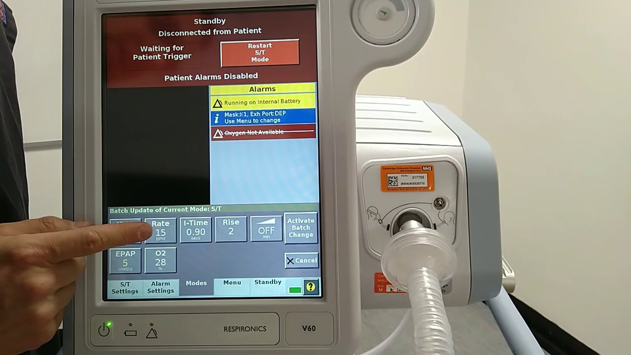 Quick setup guide: Deliver BIPAP with the Phillips V60
