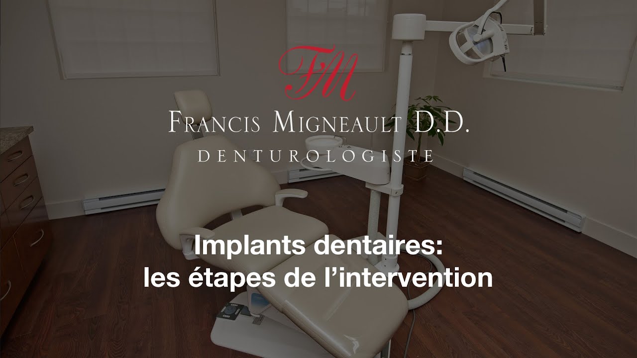 Implants dentaires: étapes de l'intervention par le denturologiste Francis Migneault (450) 444-5051