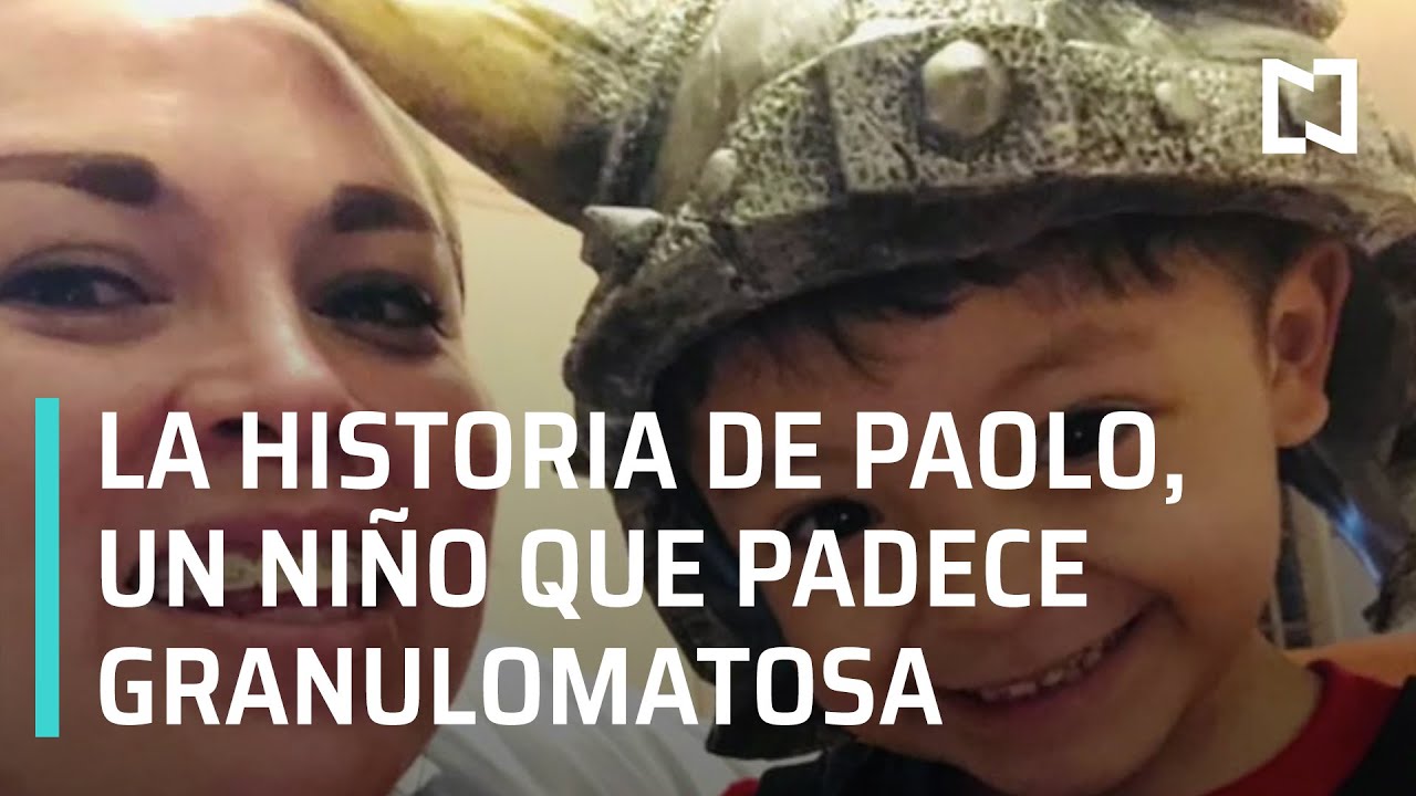 Paolo es un niño de 3 años que padece “Granulomatosa” y busca donadores de médula ósea