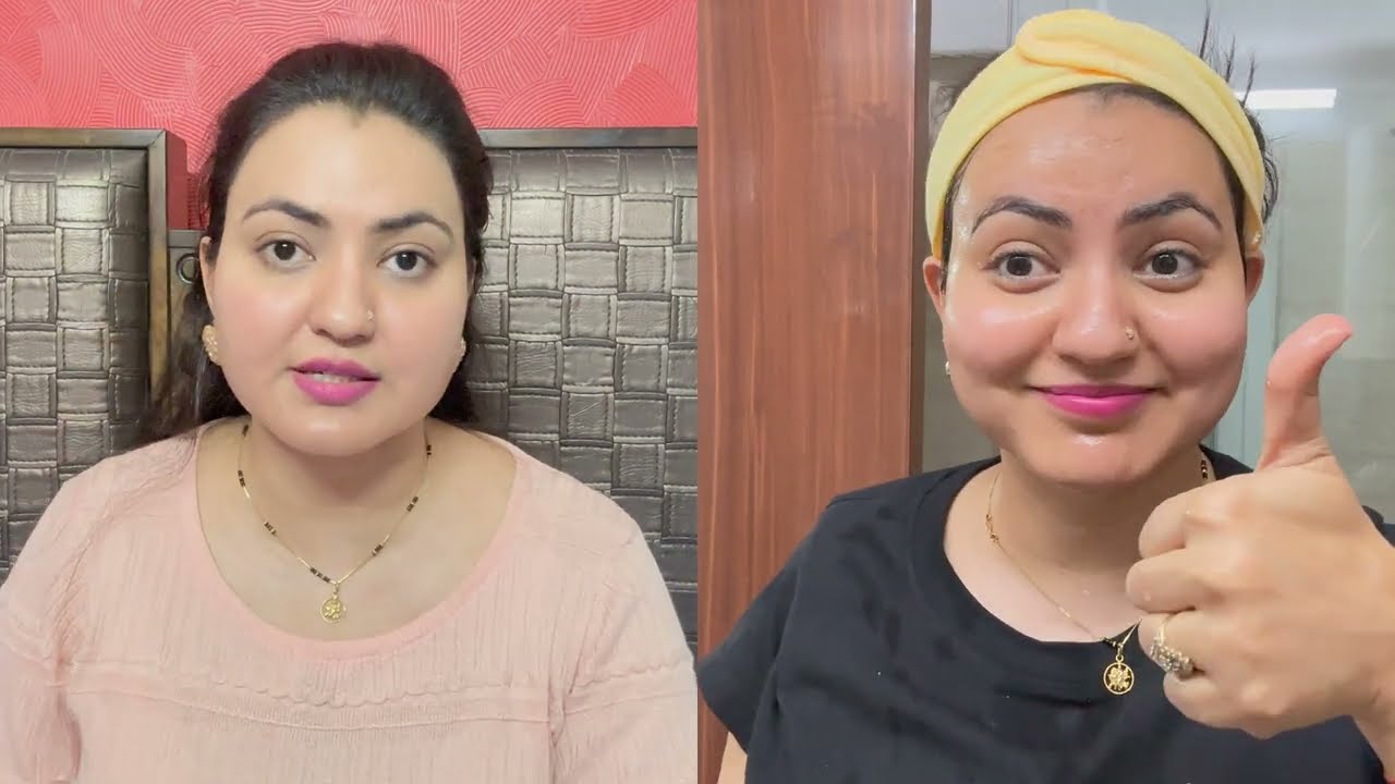 चेहरे का कालापन Dark Skin की समस्स्या को जड़ से ठीक करें | 100% Results💕