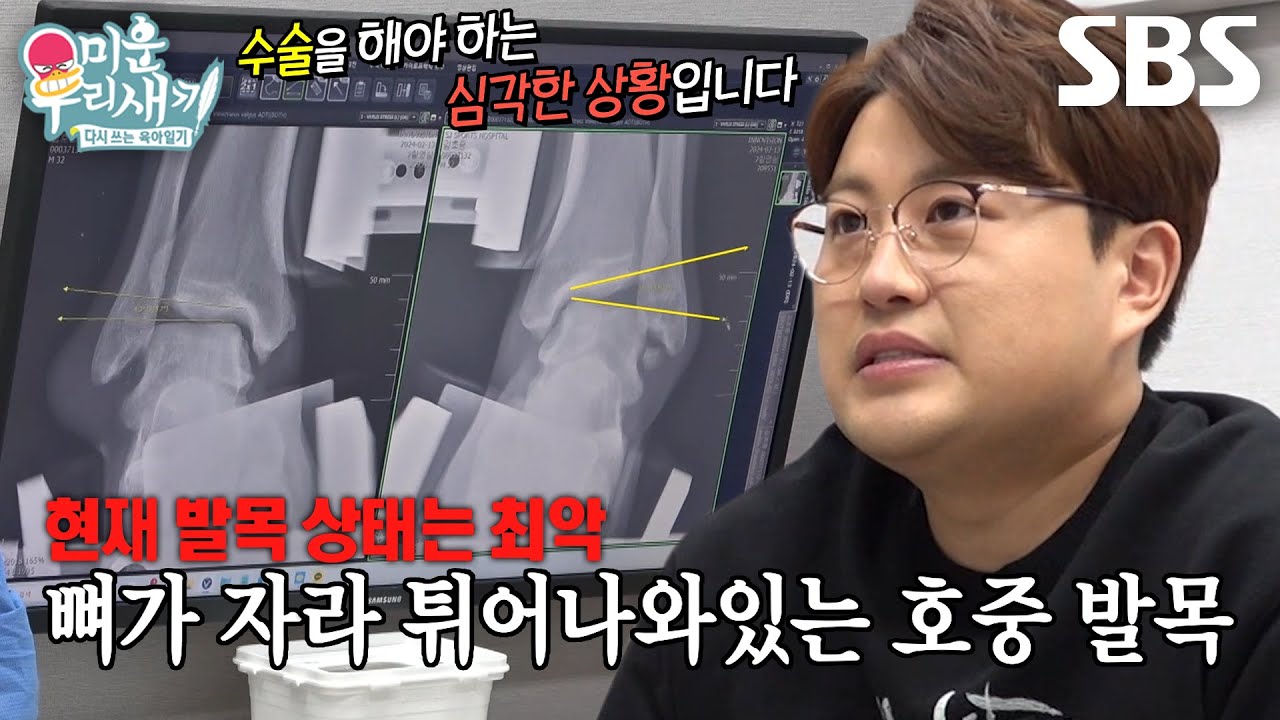 “걷지도 못할 만큼..” 김호중, 심상치 않은 발목 상태에 막힌 말문 #미운우리새끼 #MyLittleOldBoy #SBSenter