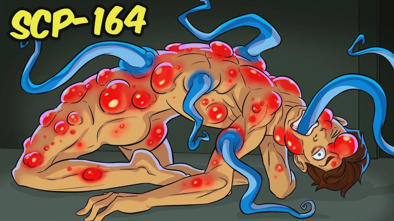 Tumores de calamar: el misterio del SCP-164