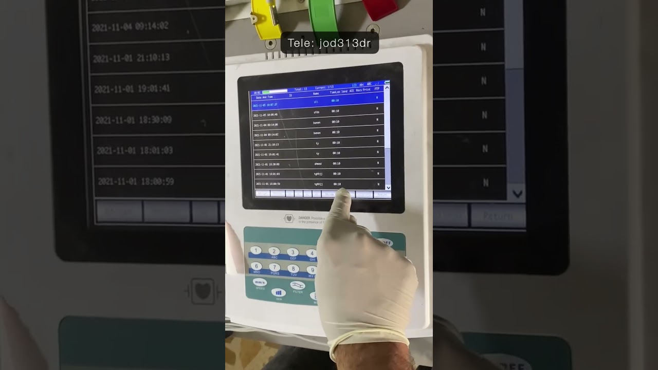 شرح جهاز تخطيط القلب ECG شركة CONTEC من ناحية الأجزاء والإعدادات