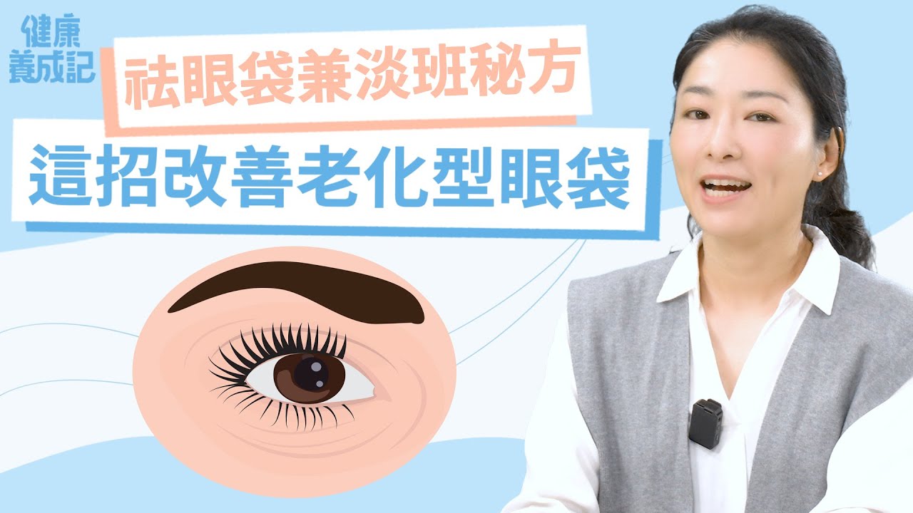 【預】三重點延緩老化，縮小眼袋！臉骨鬆垮型眼袋免醫美，靠這招！穴道＋運動改善眼袋困擾｜陳俊如｜健康養成記