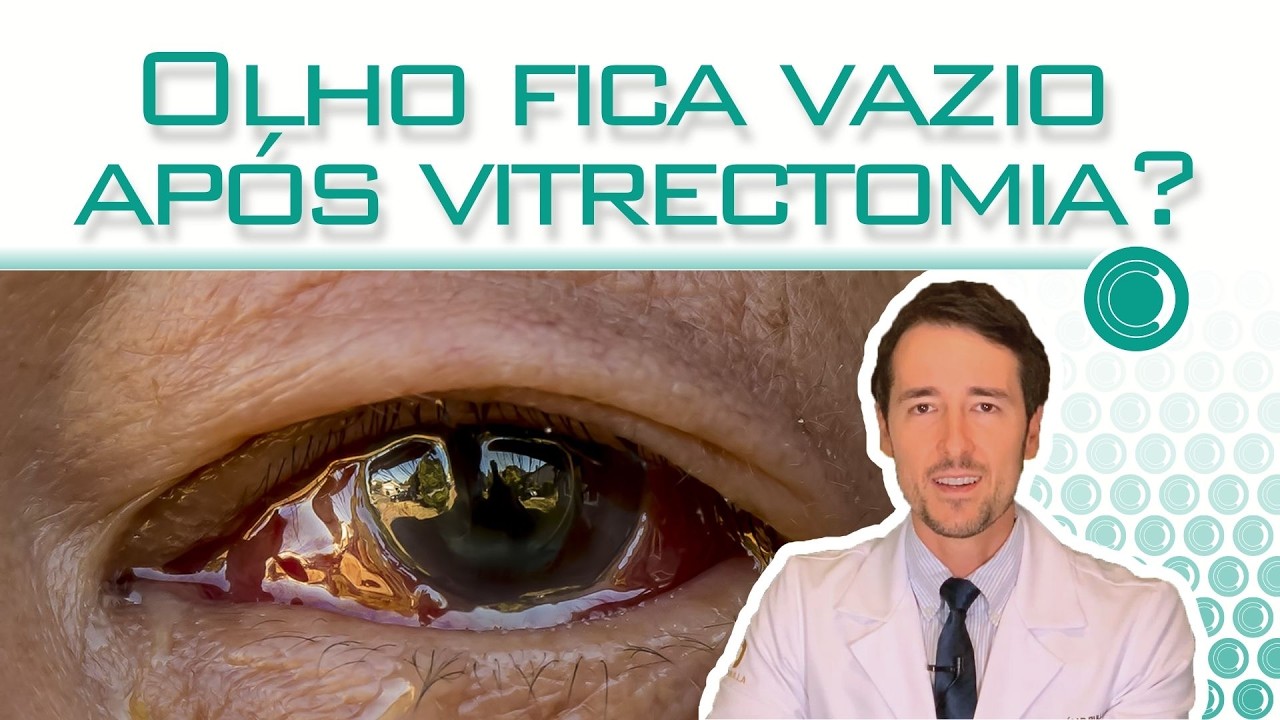 O olho fica vazio após a vitrectomia?
