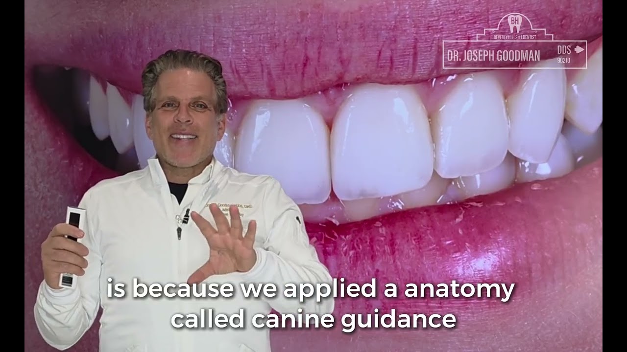 Canine Guidance Explained: How Bite Correction Makes Veneers Last 20+ Years | Beverly Hills Dentist