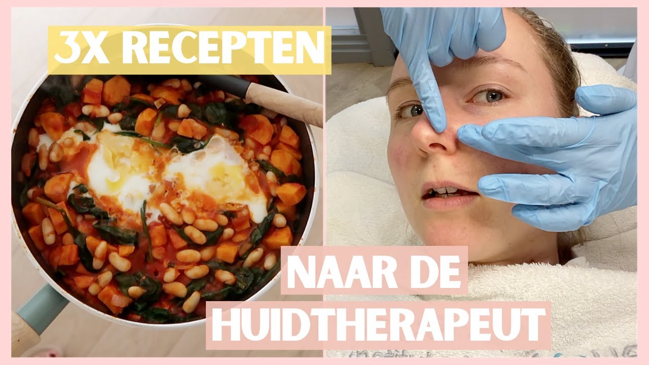 Couperose LASEREN & 3 gezonde, lekkere RECEPTEN | Weekvlog #182 | Wil & Tien