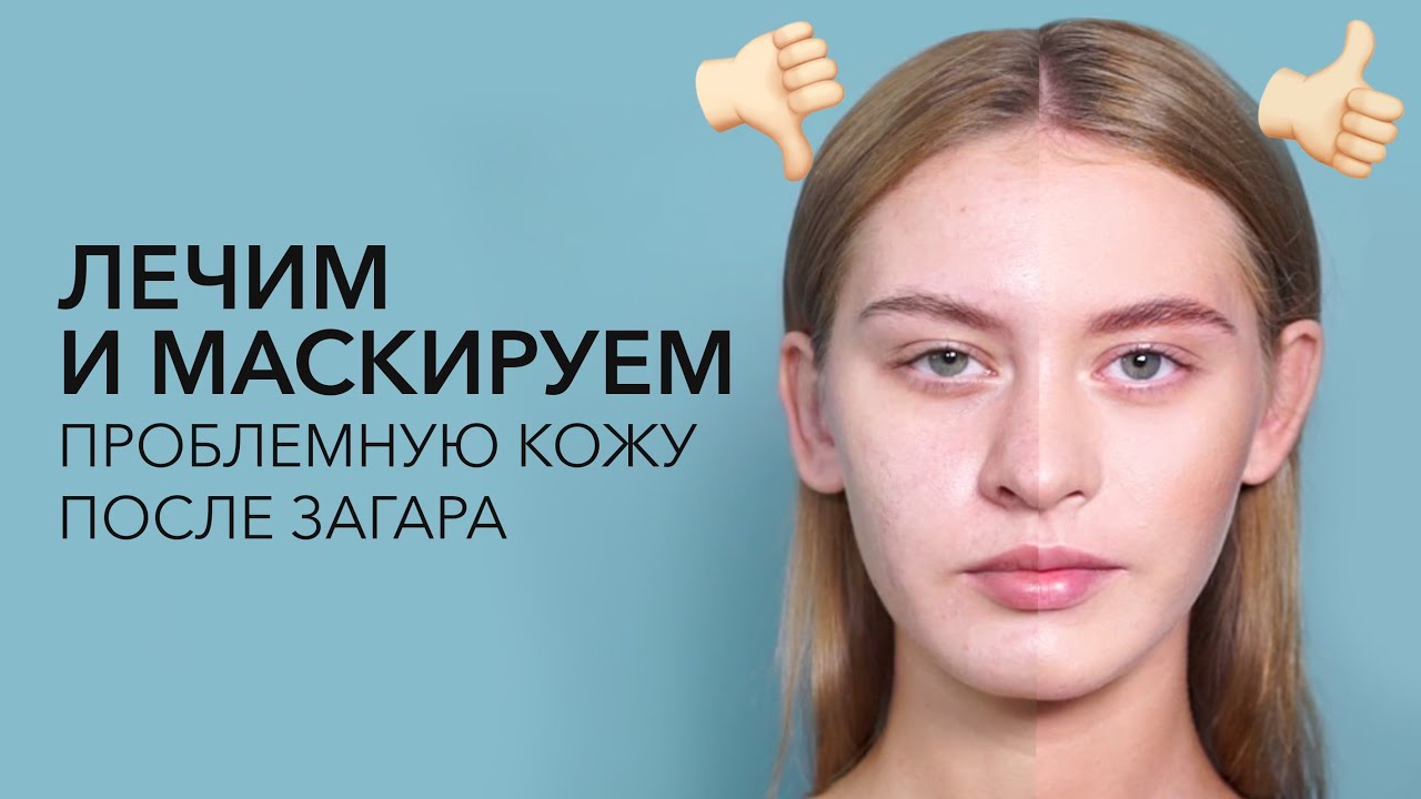 Скрыть прыщи минеральной косметикой / Макияж для проблемной кожи