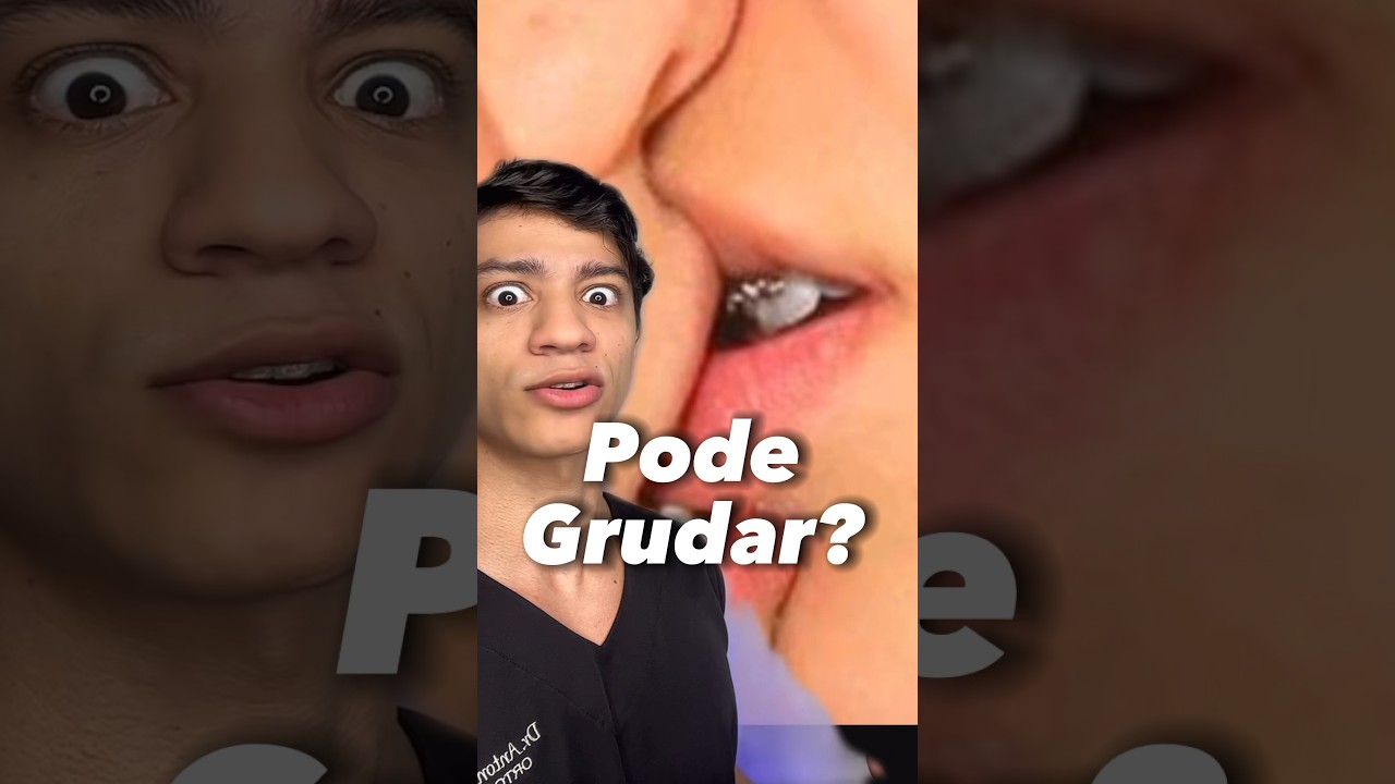 3 Dicas para seu Beijo Não ser Ruim se você acabou de Botar Aparelho!! #shorts