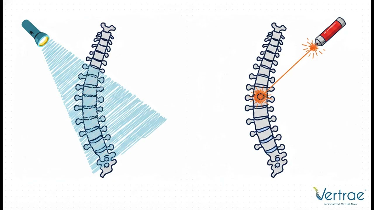 Dorsal Root Ganglion Stimulation Explained: Precision Pain Relief for Focal Nerve Pain - Dr. Woods