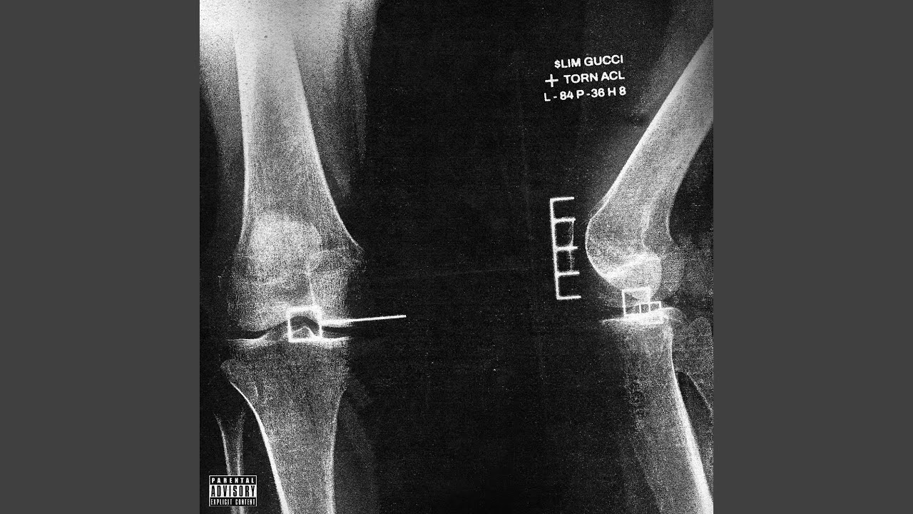 Torn Acl