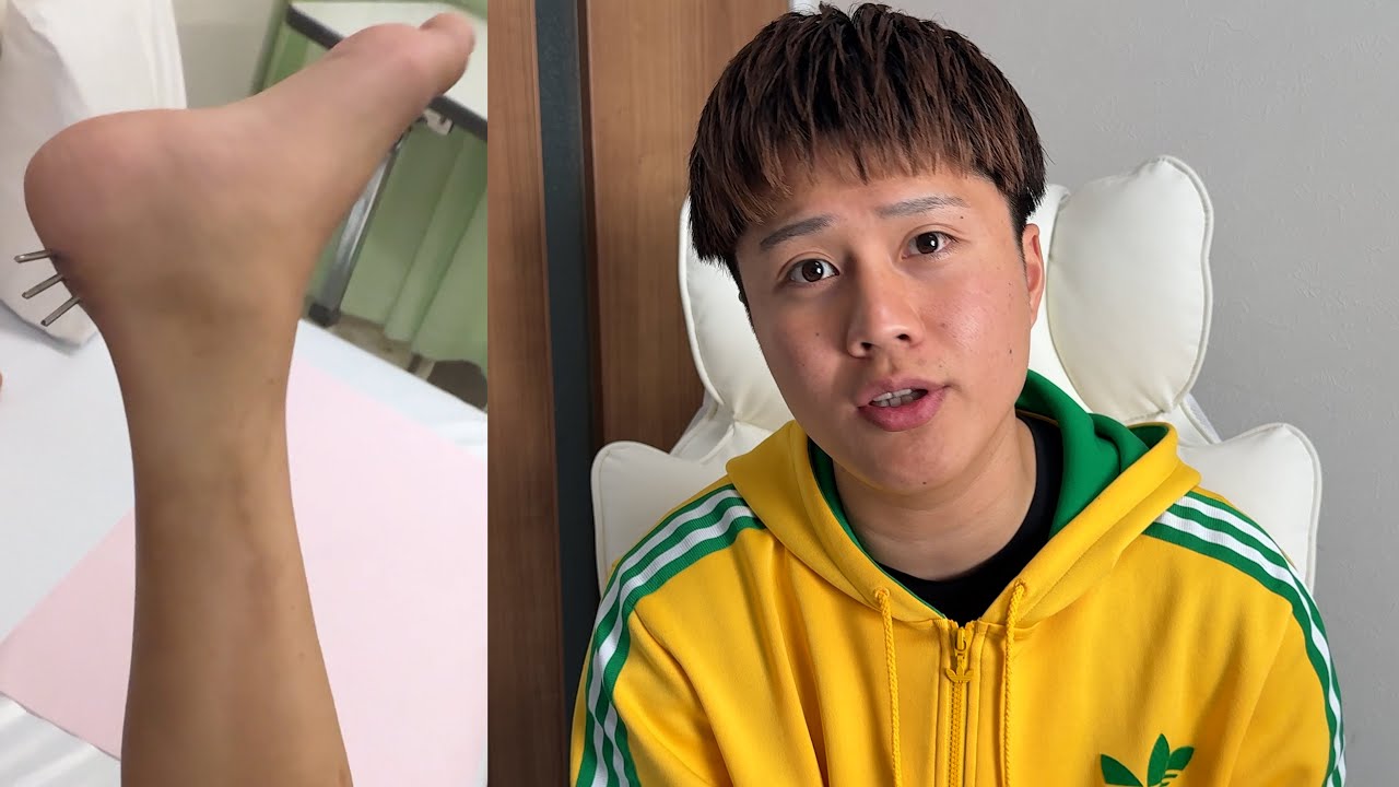 足から針金が生えてきました【釣り無し】