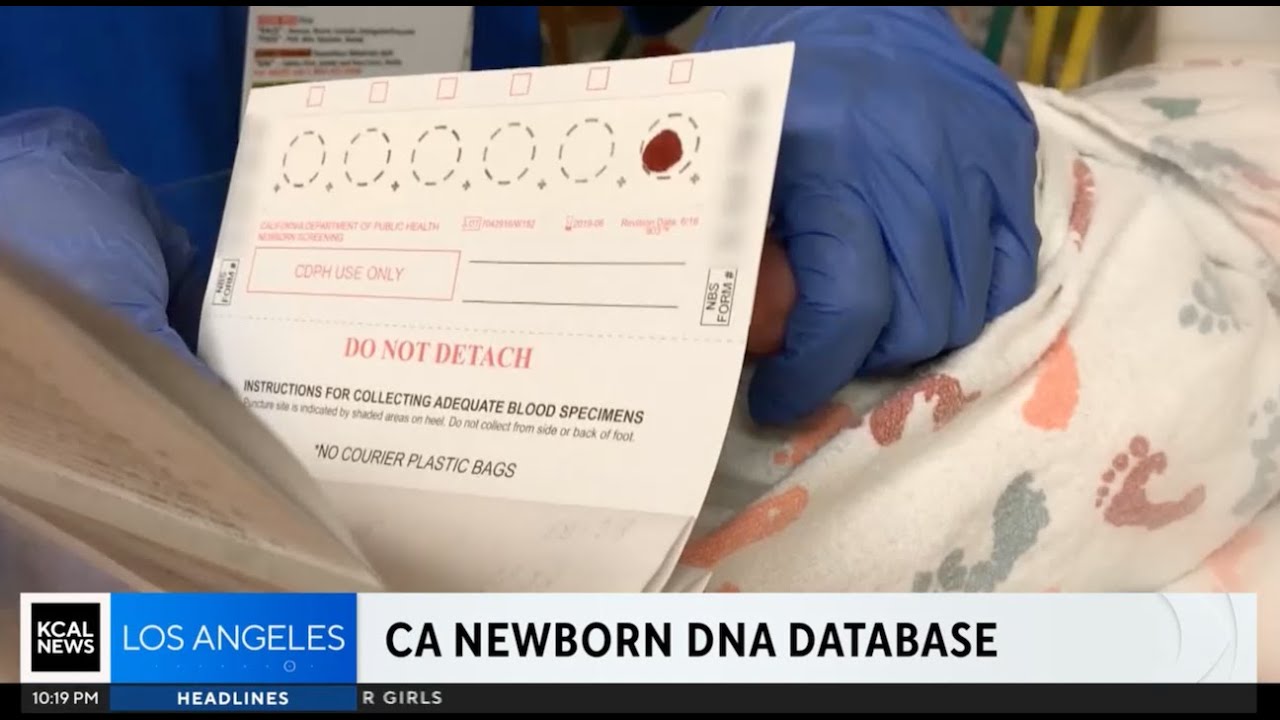 KCAL-LA - Los Angeles, CA: Investigation Into California's Newborn DNA Database