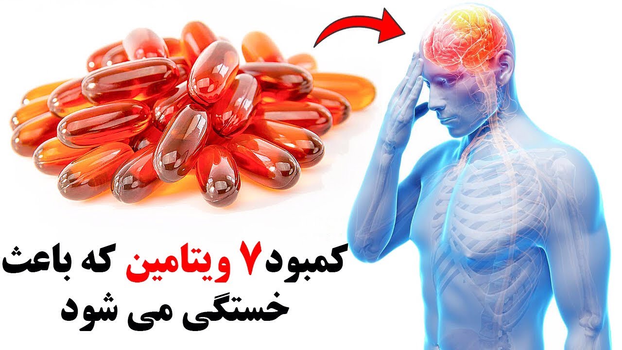کمبود هفت ویتامین که باعث خستگی و ضعف می شود