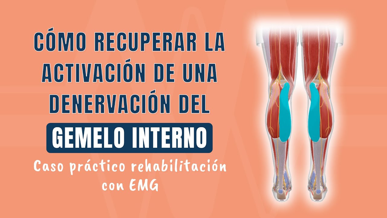 Cómo recuperar la activación de una denervación del gemelo interno