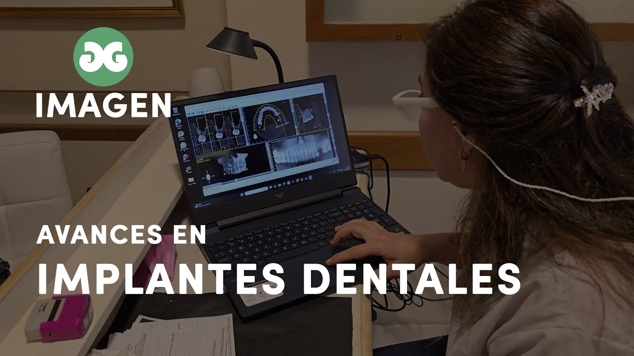 Avances en Implantes Dentales- Dra. Luciana Abdala 