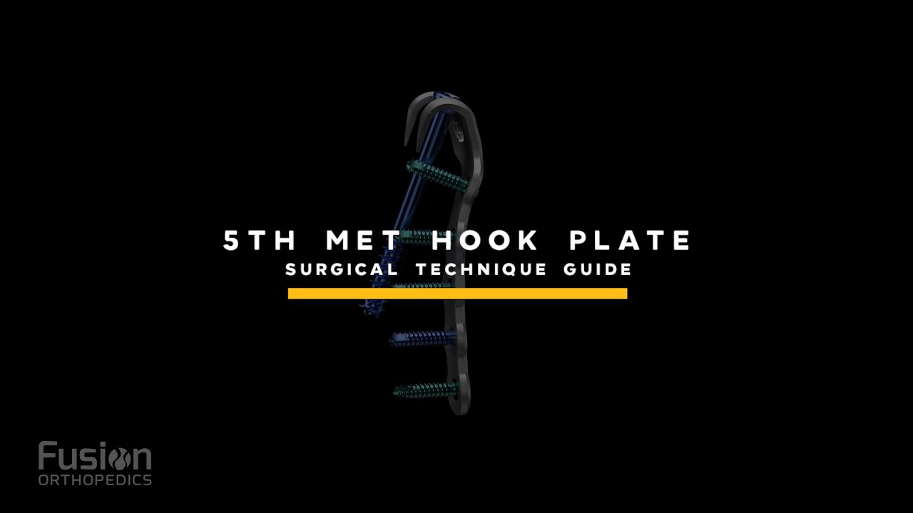 PolyLock 5th Metatarsal Hook Plate Surgical Technique
