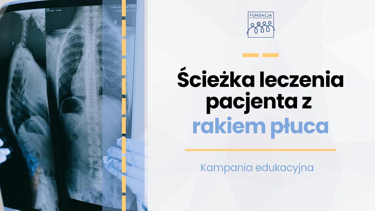 Nowoczesna diagnostyka i leczenie raka płuca - Ścieżka leczenia pacjenta z rakiem płuca