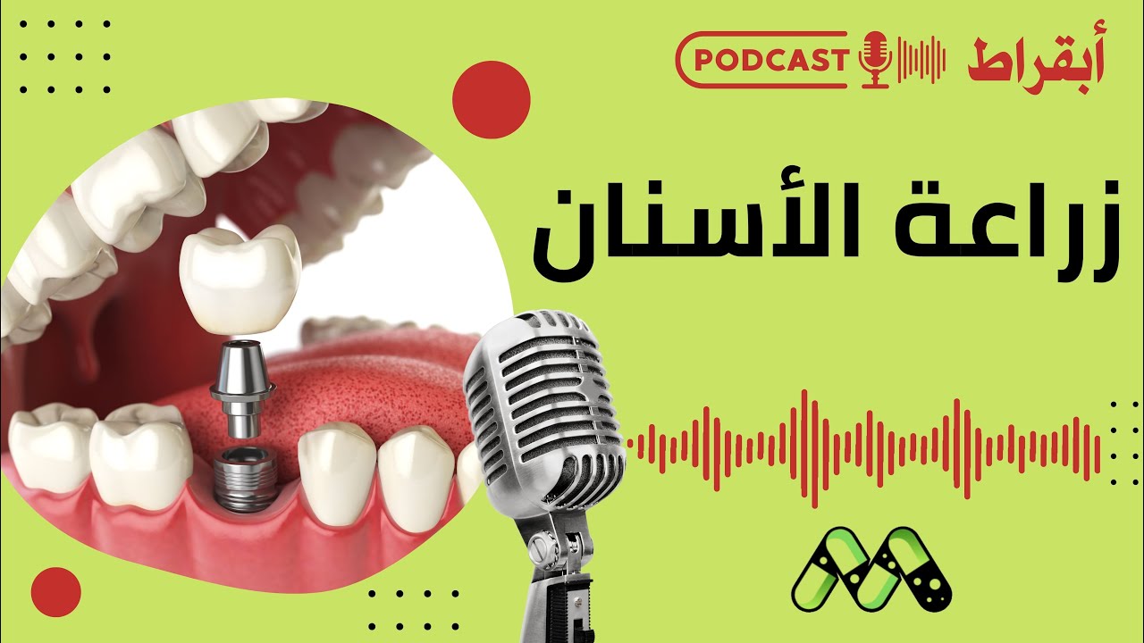زراعة الأسنان: وداعًا للألم والفجوات.. كل ما تريد معرفته | بودكاست أبقراط