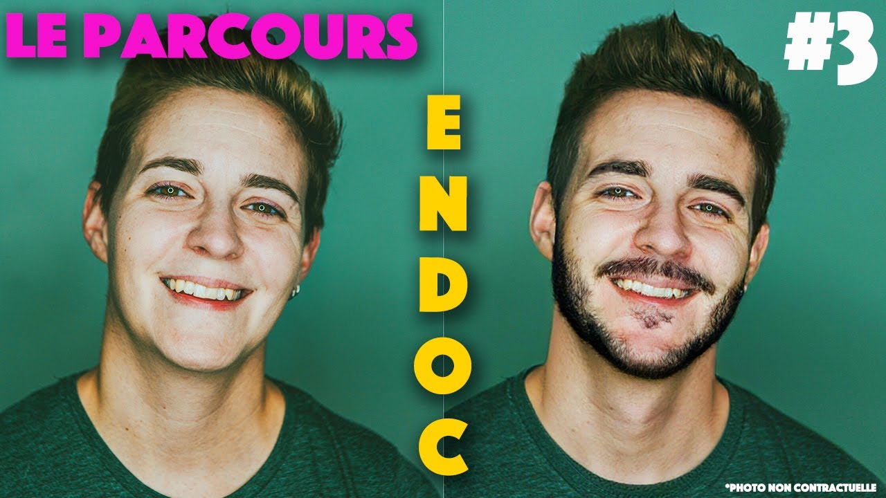 LE PARCOURS D'UNE TRANSITION FTM -  #3 L'ENDOCRINOLOGUE