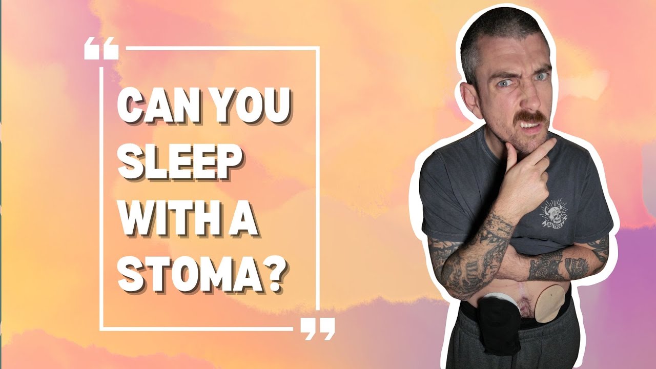 People Ask Me These Awkward Questions About My Stoma…