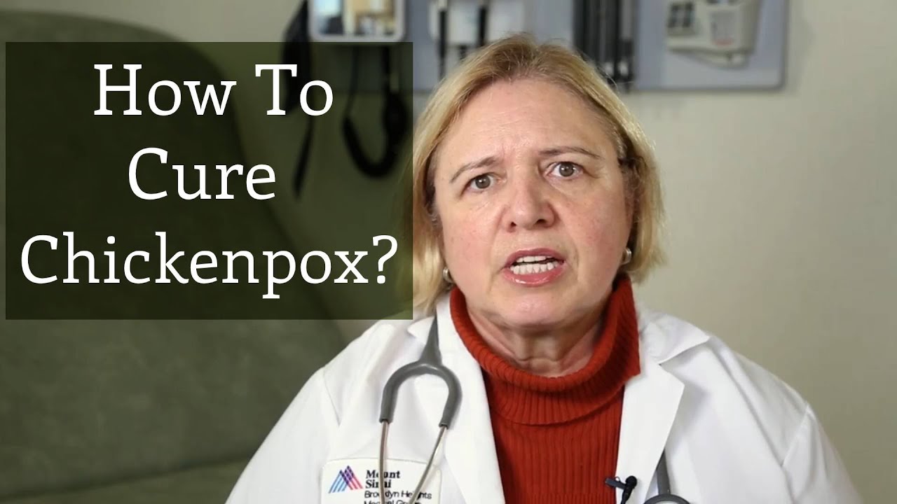 How To Cure Chickenpox?