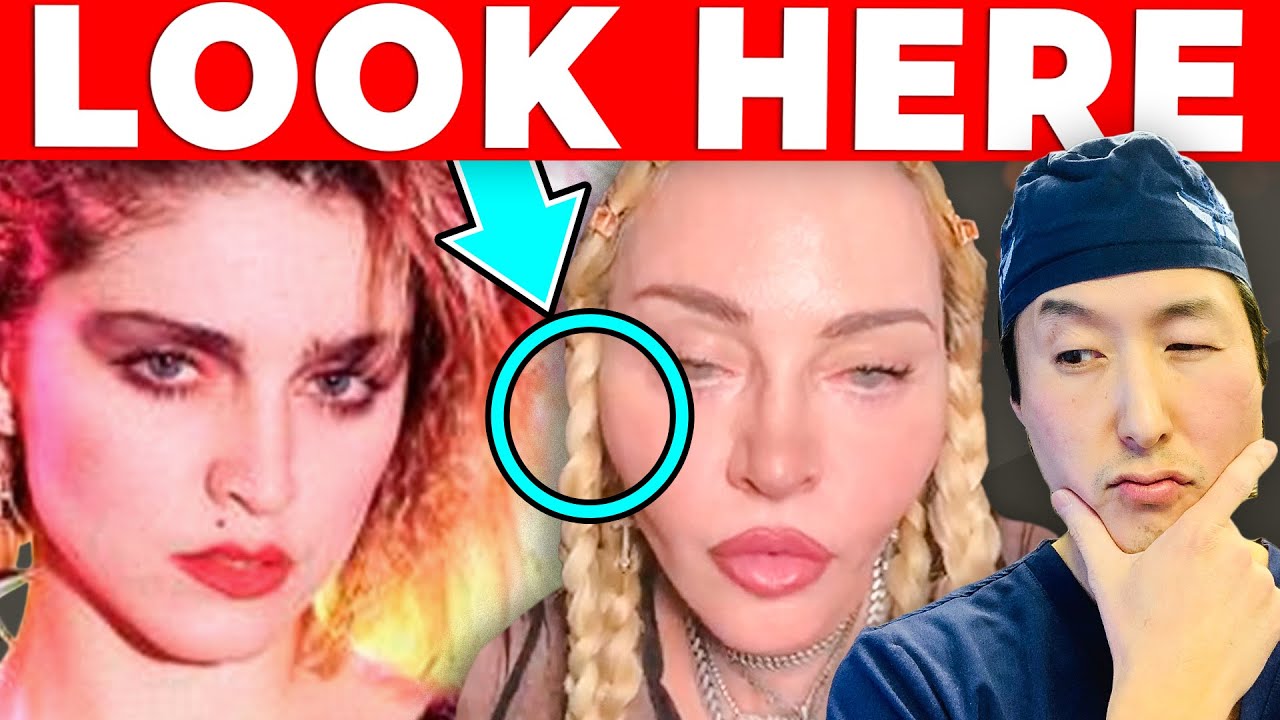 MADONNA&rsquo;S Cosmetic Surgery Transformation!