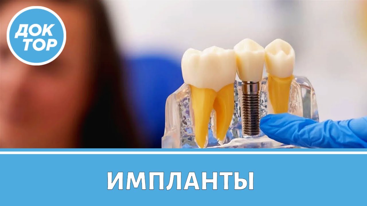 Врач-стоматолог рассказал, как продлить жизнь имплантов