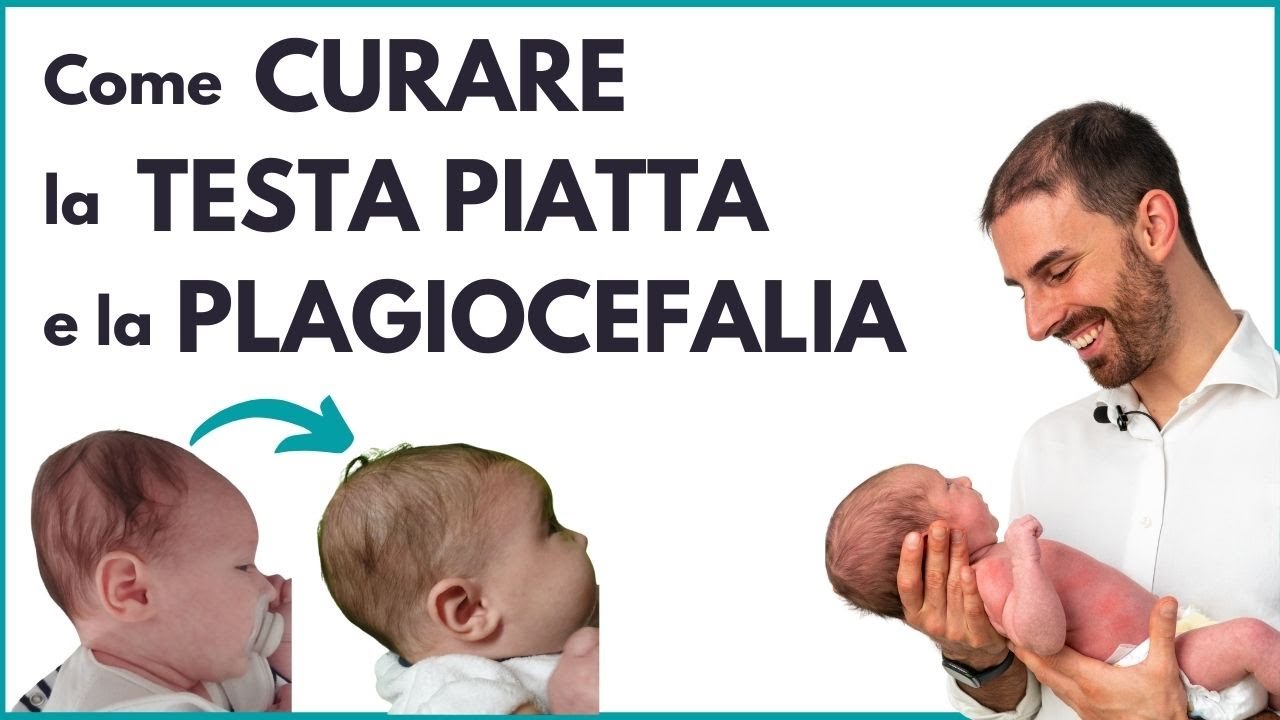 Come Curare la Testa Piatta e la Plagiocefalia posizionale del neonato (Rimedi)