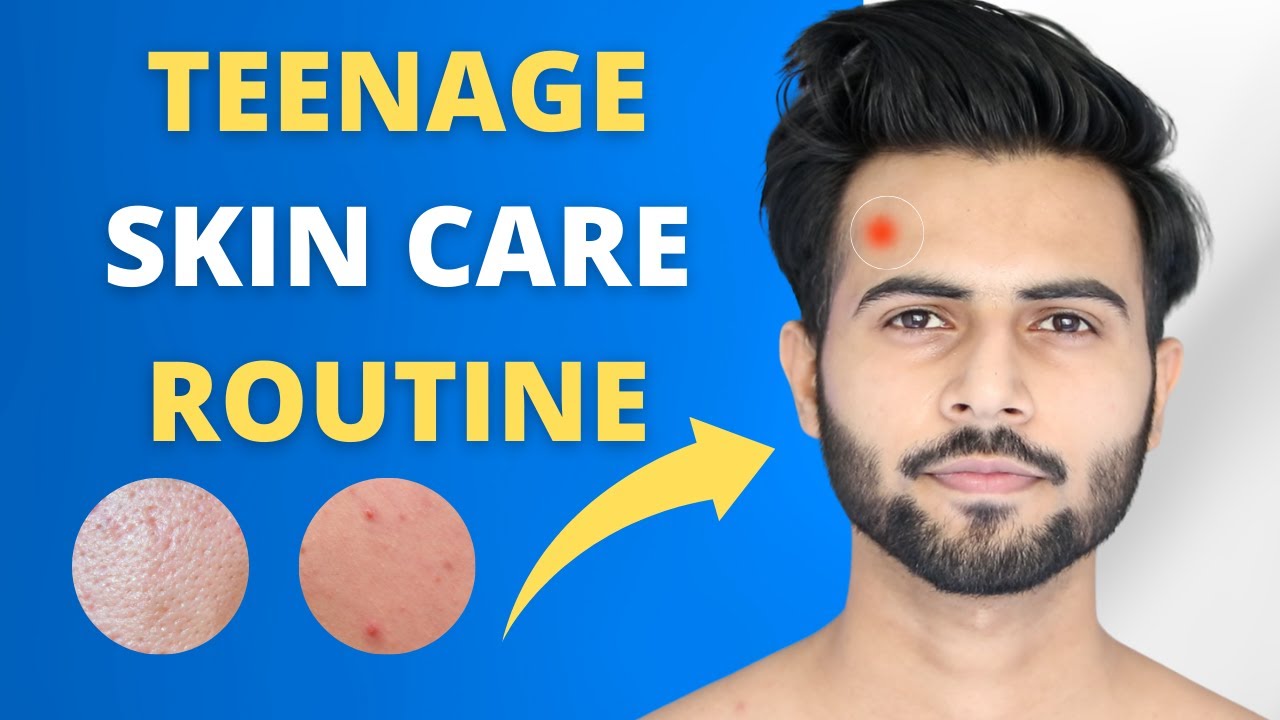 Teen Skin Care Tips | Acne Prone,oily skin | Tarun Molri