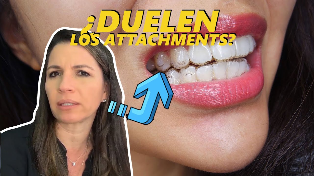 ¿Los attachments de Invisalign duelen? | Invisalign preguntas