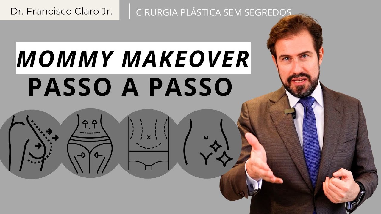 Você sabe o que é o Mommy Makeover? Confira aqui o passo a passo desse conjunto de cirurgias!