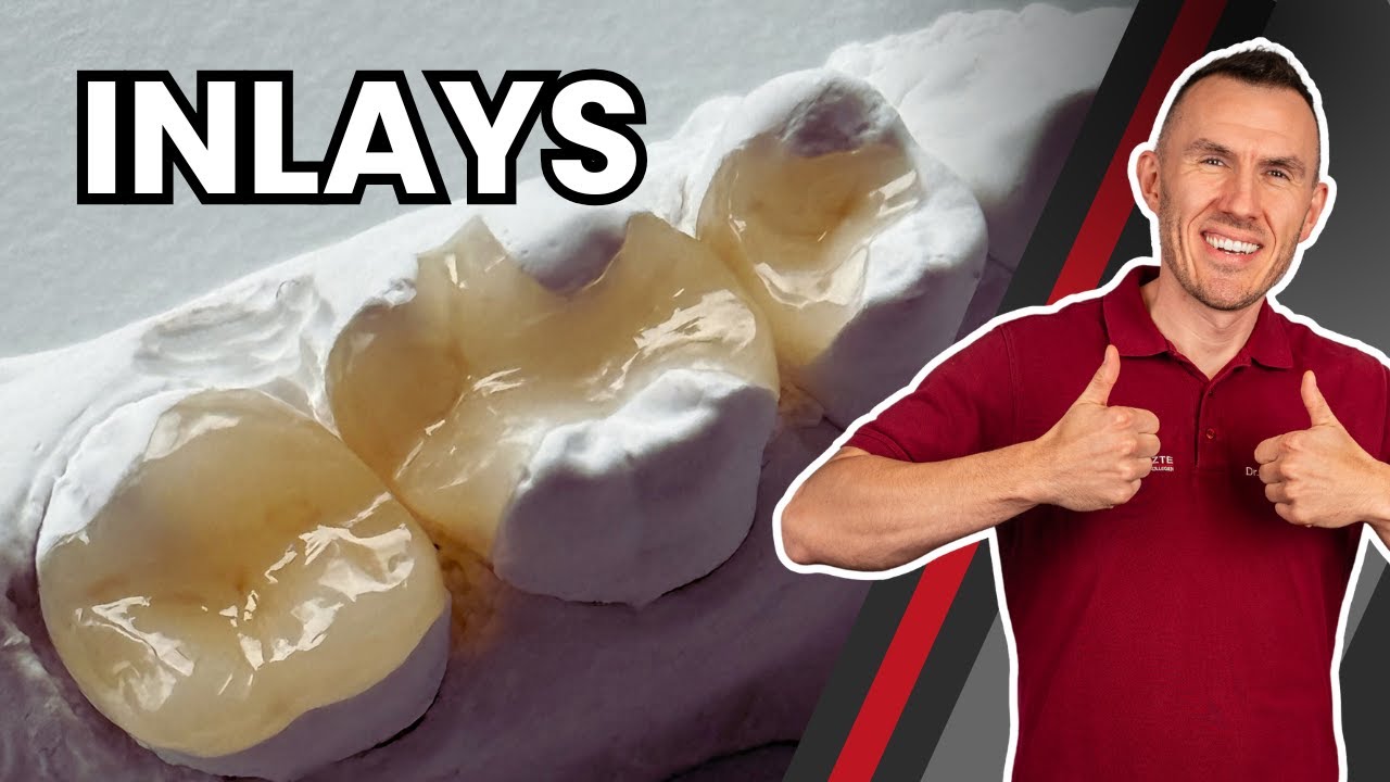 Alles über Zahn Inlays! Vorteile | Nachteile | Ablauf der Behandlung | Dr. Brauckmann