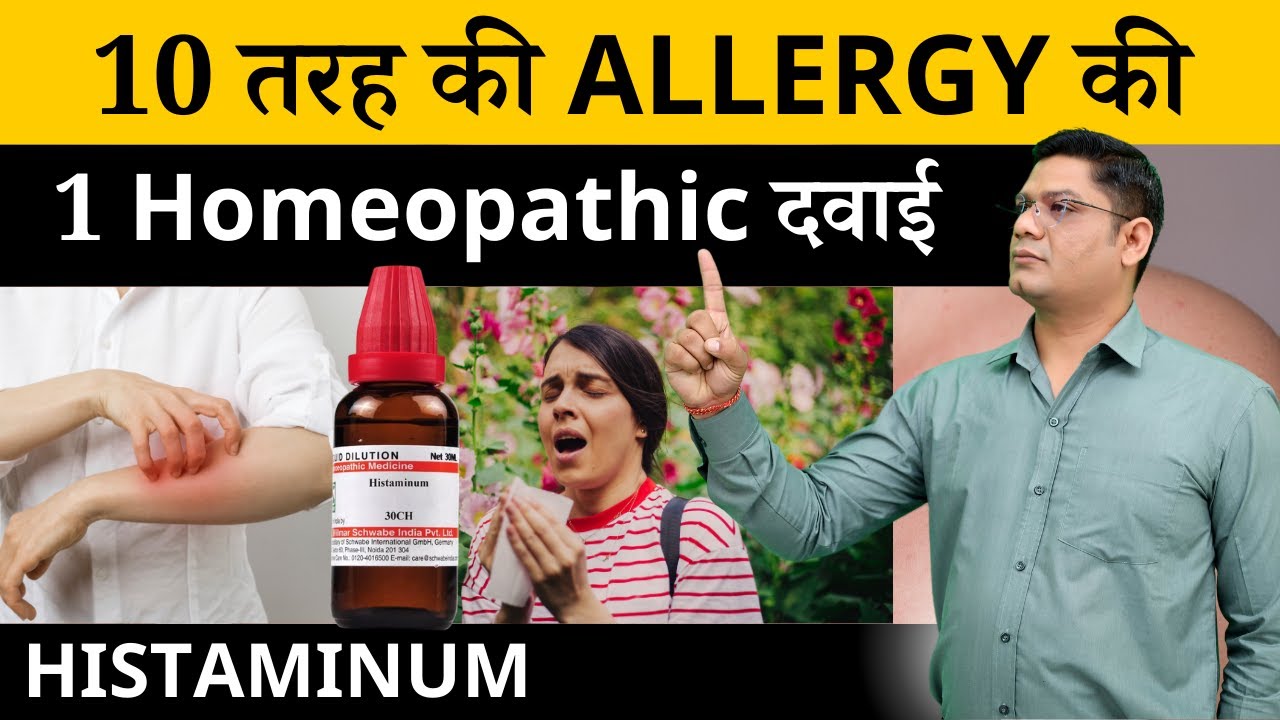Treatment of Every Allergy | Homeopathic Medicine for Allergy | Histaminum | Sunil Patidar 