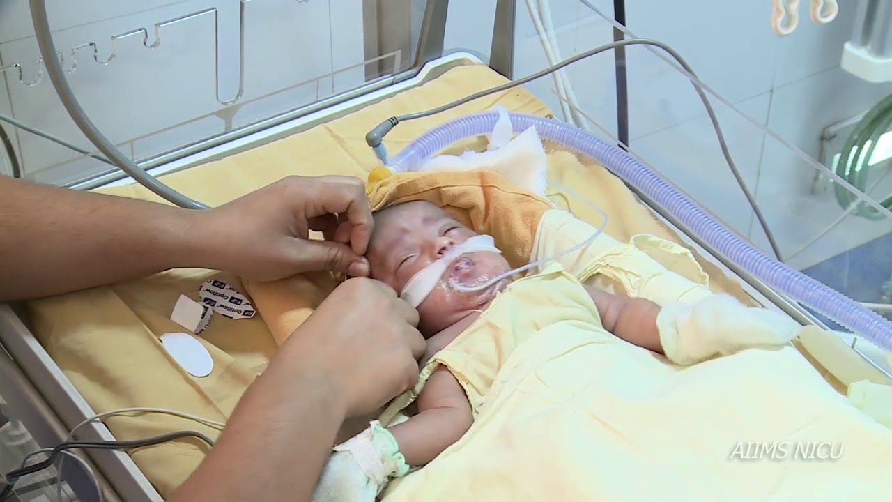 How to fix HHHFNC interface for a newborn baby?