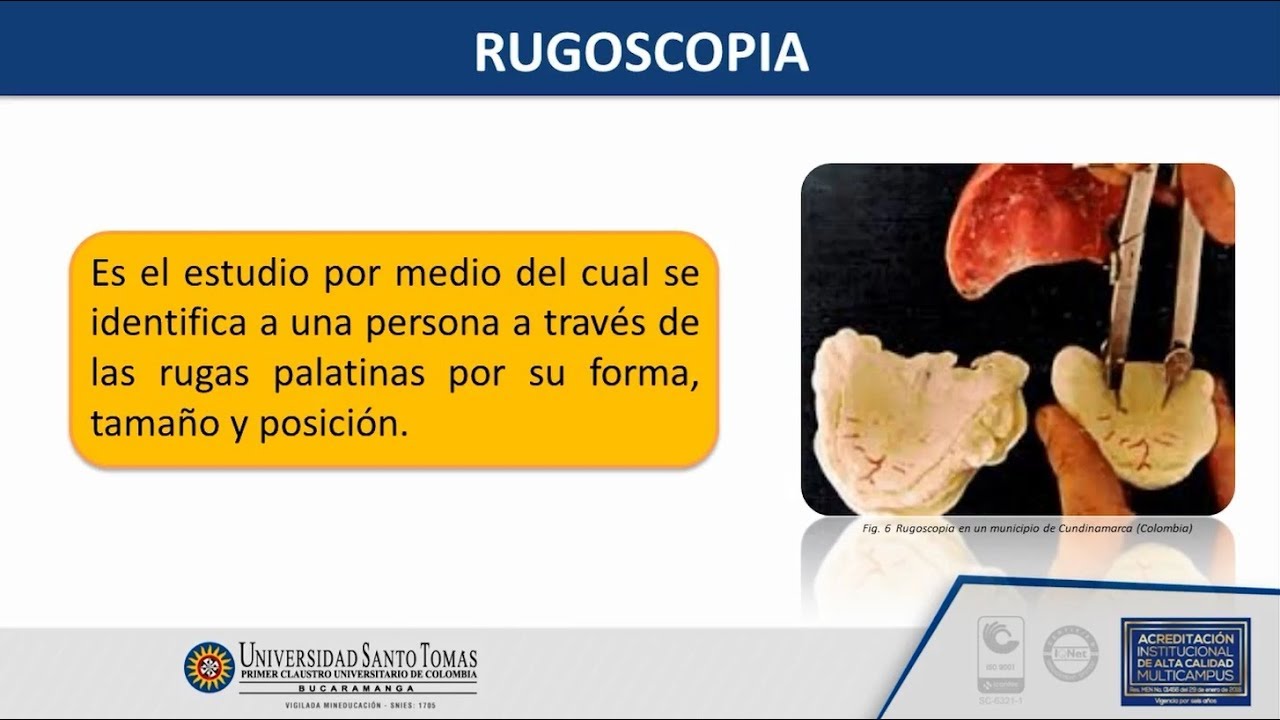 Método Rugoscopia USTABuca