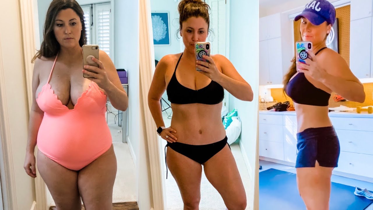 I Lost 60 lbs with Keto in 6 months + Got a Tummy Tuck (Before and After in Pictures) 2021
