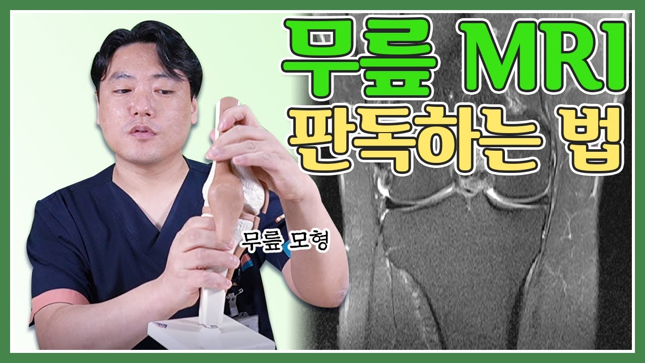 조금이라도 우리 무릎 상태를 아는 데 도움이 되는🦵🏻무릎 MRI 판독하는 법 💥