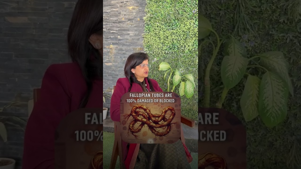 🎙️ IVF: Myths vs Reality – Let’s Clear the Air!