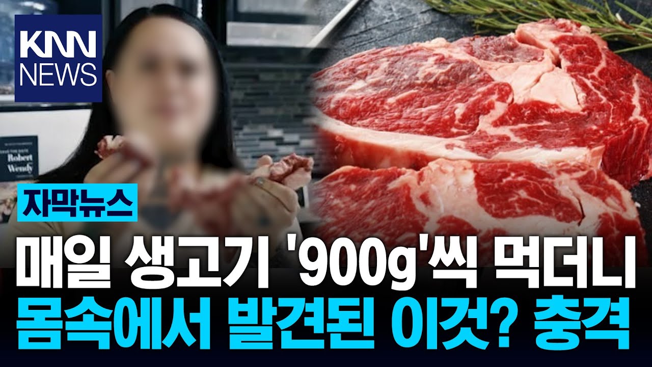 핏물 뚝뚝 '생고기' 중독녀 건강 검진했더니 충격 결과?/ KNN