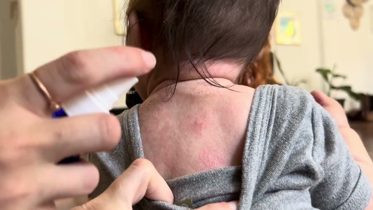 LiviaOne Topical Liquid Probiotics Spray Review