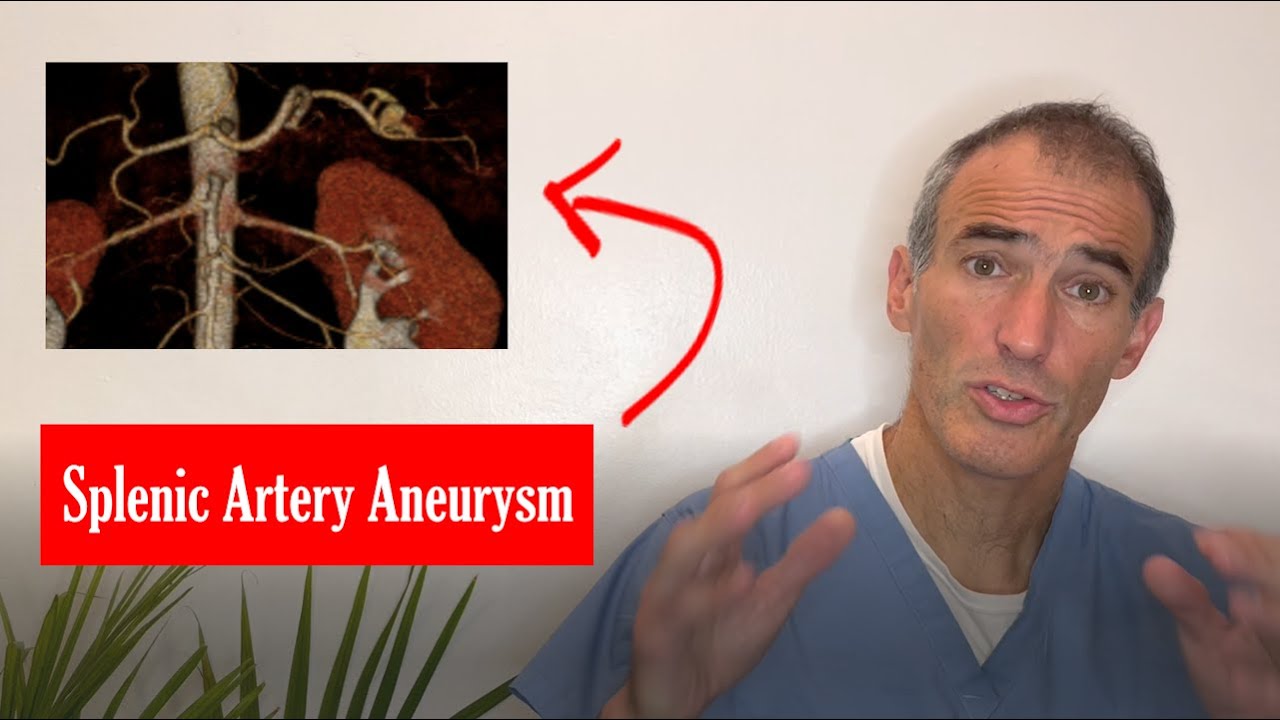 Splenic Artery Aneurysm