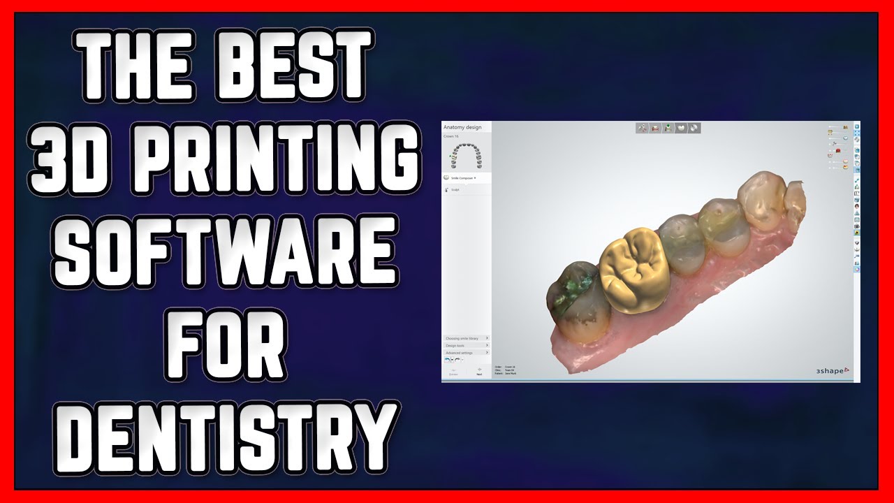 🦷 The 3 Best FREE 3D Printing Software for Dentists