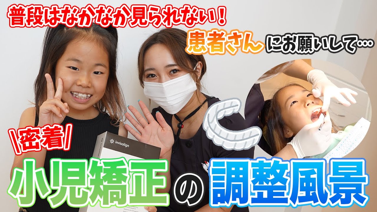 【小児矯正】患者さんにお願いして矯正の調整風景を撮らせてもらいました！【名古屋茶屋歯科・矯正歯科】