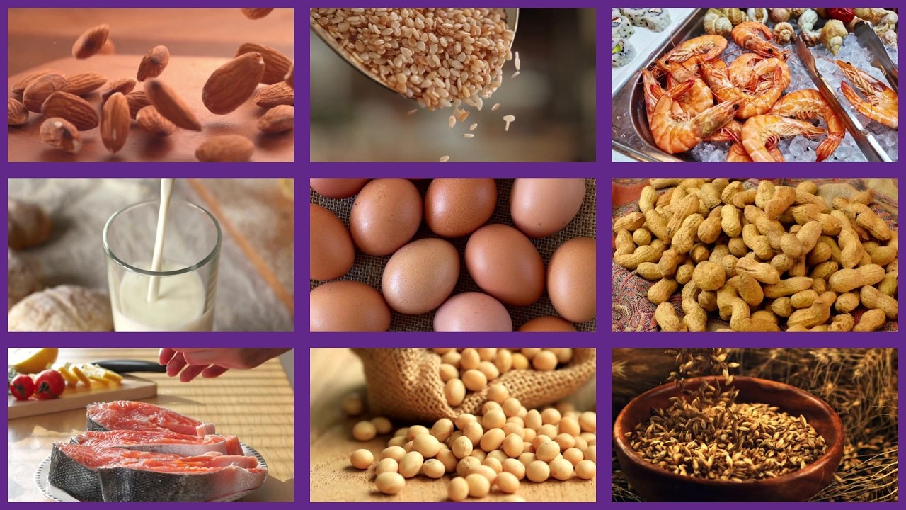 Food Allergies